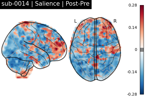 sub-0014_Salience_diff-comparison.png