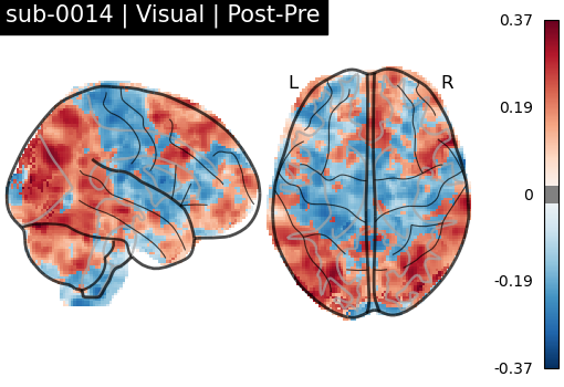 sub-0014_Visual_diff-comparison.png