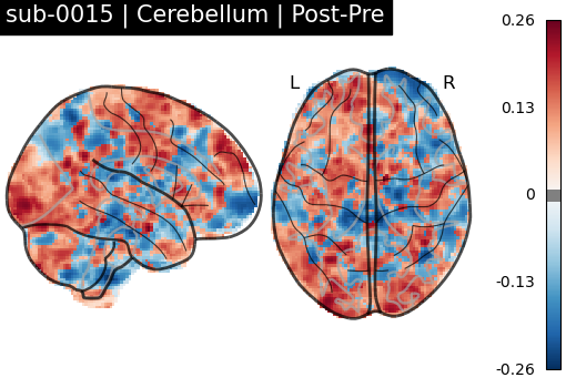 sub-0015_Cerebellum_diff-comparison.png