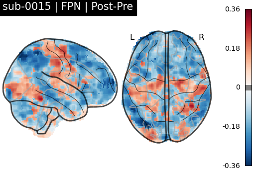 sub-0015_FPN_diff-comparison.png