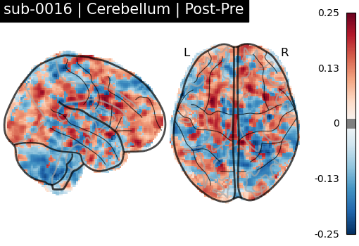 sub-0016_Cerebellum_diff-comparison.png