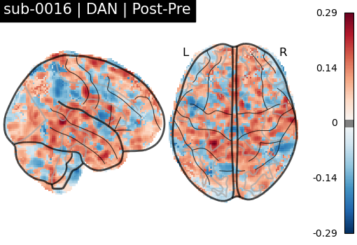 sub-0016_DAN_diff-comparison.png