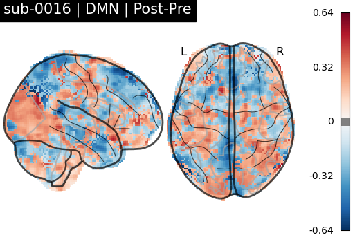 sub-0016_DMN_diff-comparison.png