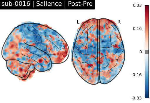 sub-0016_Salience_diff-comparison.png