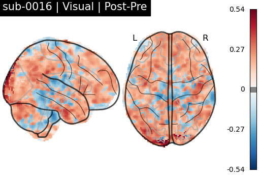 sub-0016_Visual_diff-comparison.png
