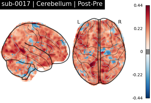 sub-0017_Cerebellum_diff-comparison.png