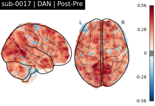 sub-0017_DAN_diff-comparison.png
