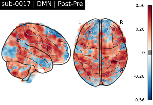 sub-0017_DMN_diff-comparison.png