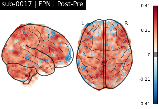 sub-0017_FPN_diff-comparison.png