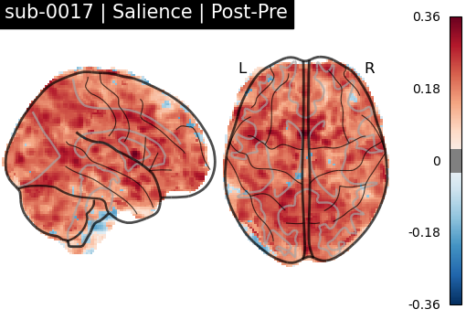 sub-0017_Salience_diff-comparison.png