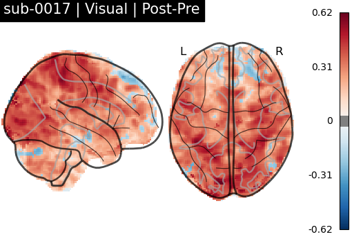 sub-0017_Visual_diff-comparison.png