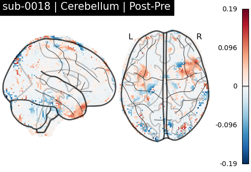 sub-0018_Cerebellum_diff-comparison.png