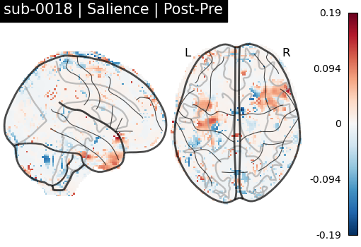 sub-0018_Salience_diff-comparison.png