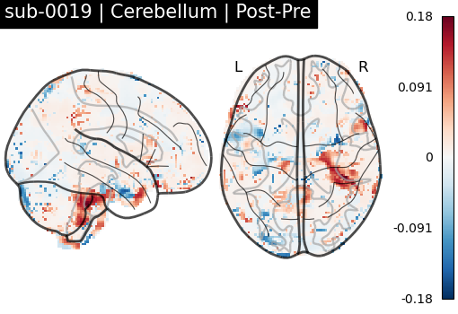sub-0019_Cerebellum_diff-comparison.png