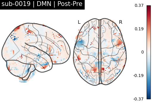 sub-0019_DMN_diff-comparison.png