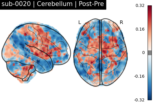sub-0020_Cerebellum_diff-comparison.png
