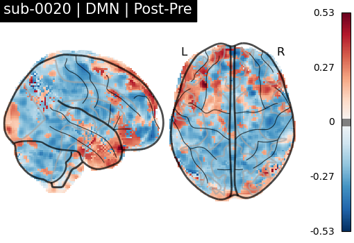 sub-0020_DMN_diff-comparison.png