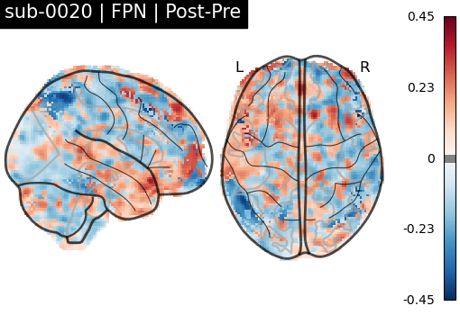 sub-0020_FPN_diff-comparison.png