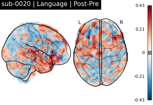 sub-0020_Language_diff-comparison.png