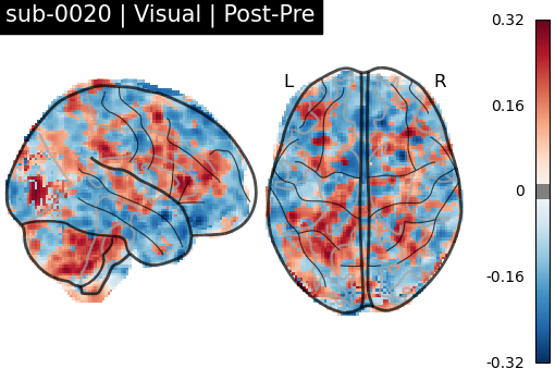 sub-0020_Visual_diff-comparison.png