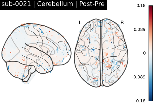 sub-0021_Cerebellum_diff-comparison.png