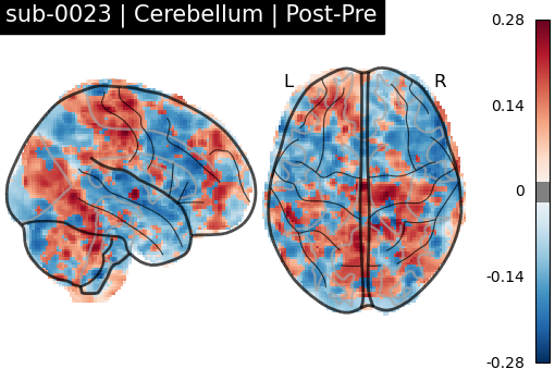 sub-0023_Cerebellum_diff-comparison.png