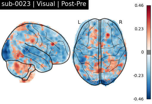 sub-0023_Visual_diff-comparison.png