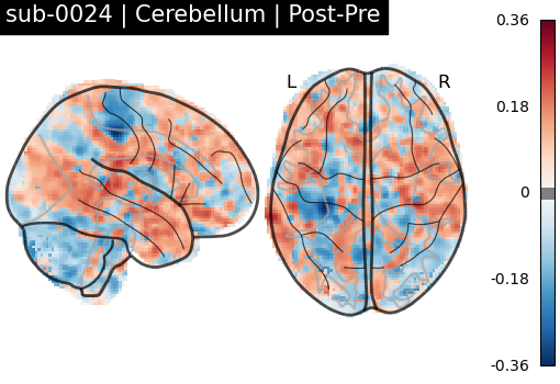 sub-0024_Cerebellum_diff-comparison.png