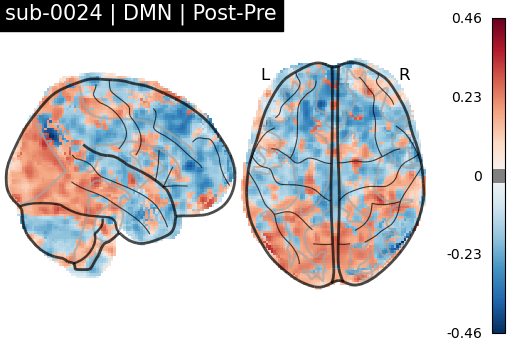 sub-0024_DMN_diff-comparison.png