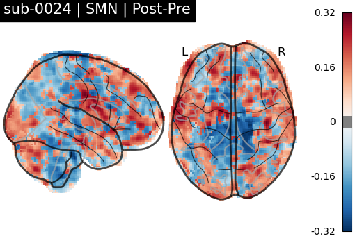 sub-0024_SMN_diff-comparison.png