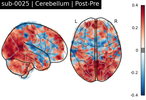 sub-0025_Cerebellum_diff-comparison.png