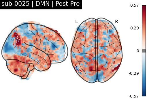 sub-0025_DMN_diff-comparison.png