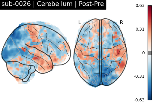 sub-0026_Cerebellum_diff-comparison.png