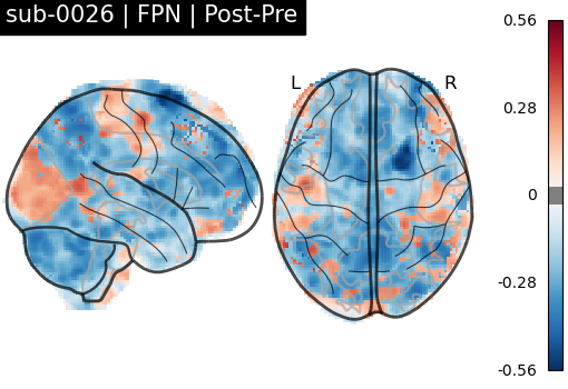 sub-0026_FPN_diff-comparison.png