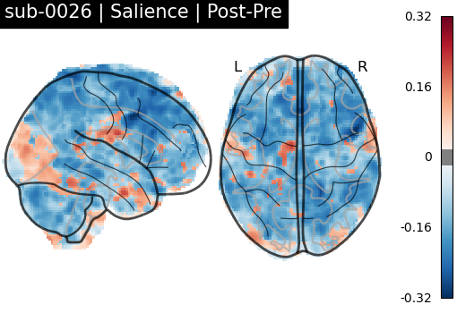 sub-0026_Salience_diff-comparison.png
