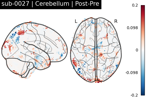 sub-0027_Cerebellum_diff-comparison.png