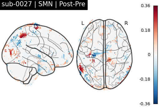 sub-0027_SMN_diff-comparison.png