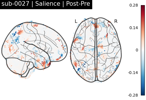 sub-0027_Salience_diff-comparison.png