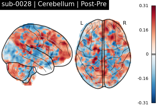 sub-0028_Cerebellum_diff-comparison.png