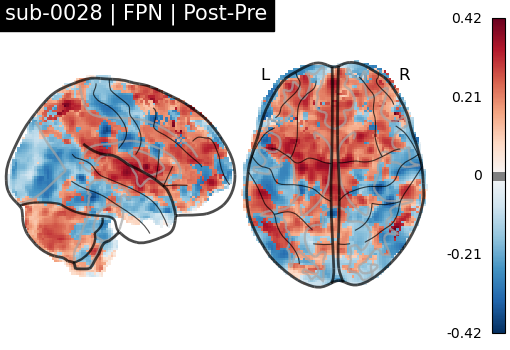 sub-0028_FPN_diff-comparison.png
