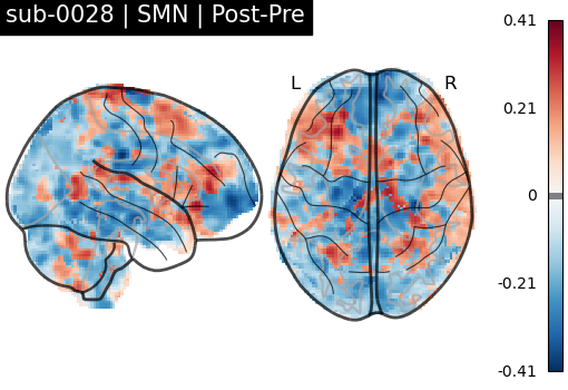 sub-0028_SMN_diff-comparison.png