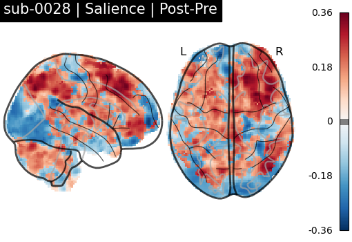 sub-0028_Salience_diff-comparison.png