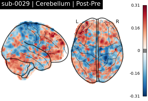 sub-0029_Cerebellum_diff-comparison.png