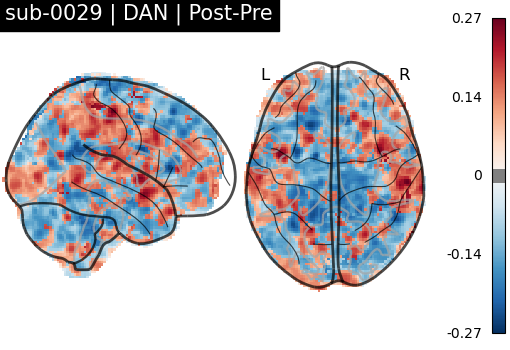 sub-0029_DAN_diff-comparison.png