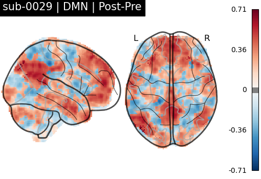 sub-0029_DMN_diff-comparison.png