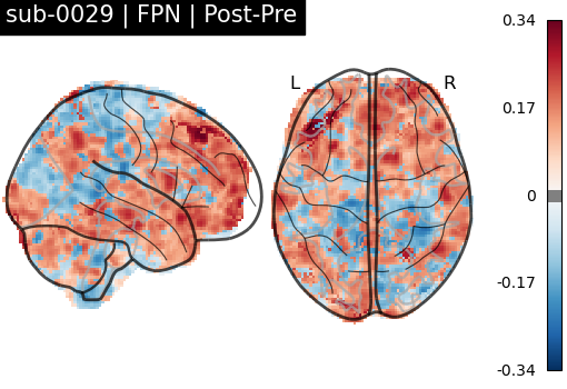 sub-0029_FPN_diff-comparison.png