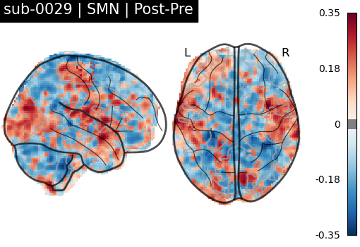 sub-0029_SMN_diff-comparison.png