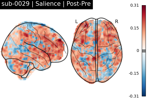 sub-0029_Salience_diff-comparison.png