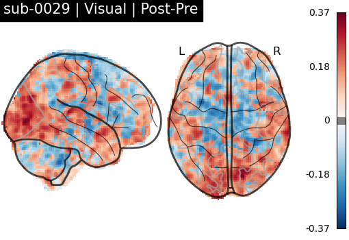 sub-0029_Visual_diff-comparison.png