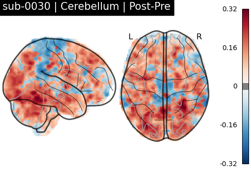 sub-0030_Cerebellum_diff-comparison.png